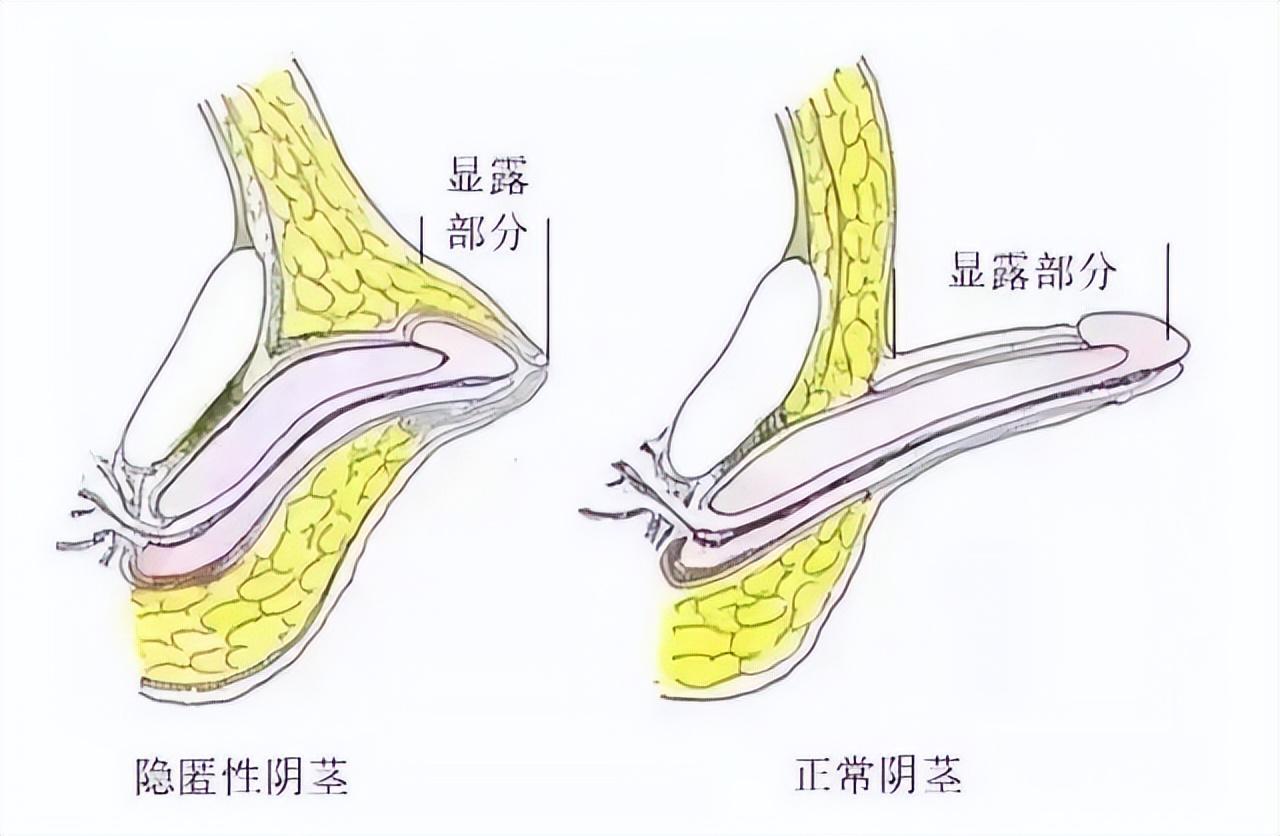 警惕！隐形杀手，疾病悄悄侵蚀孩子健康